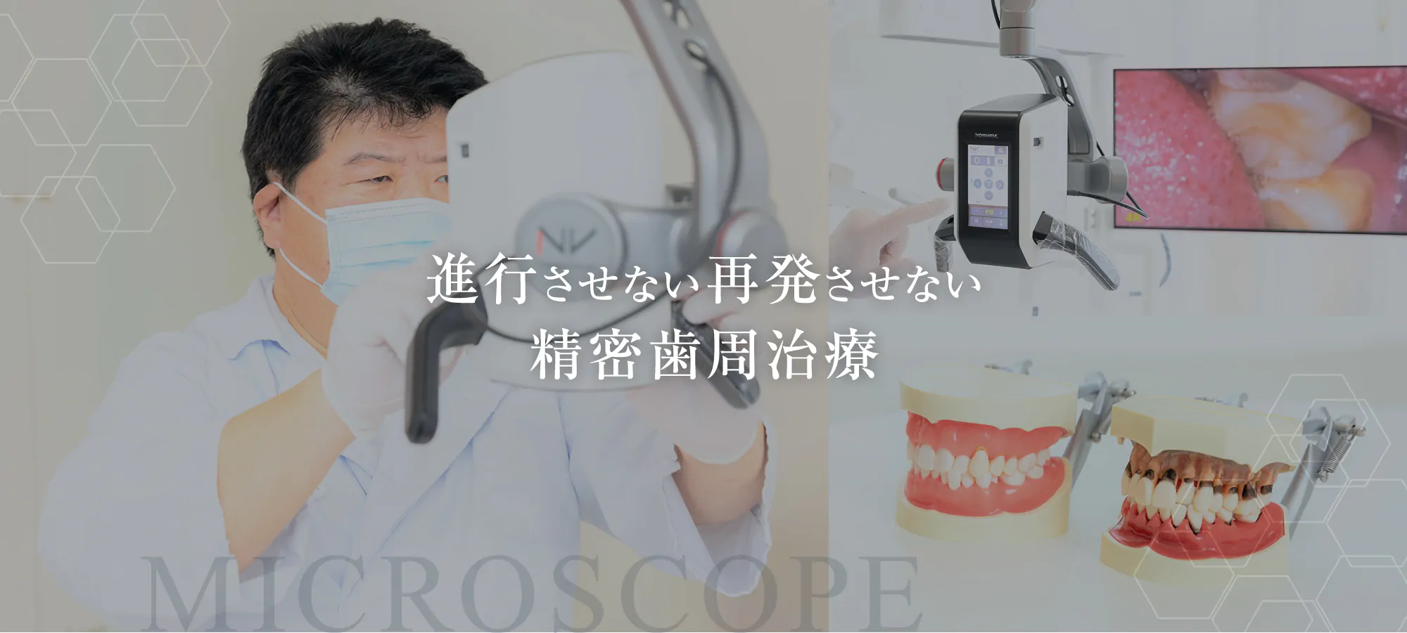 進行させない再発させない精密歯周治療