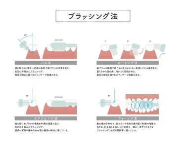 丁寧なブラッシング