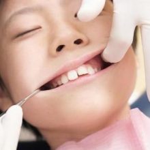 小児歯科で治療を受ける子供