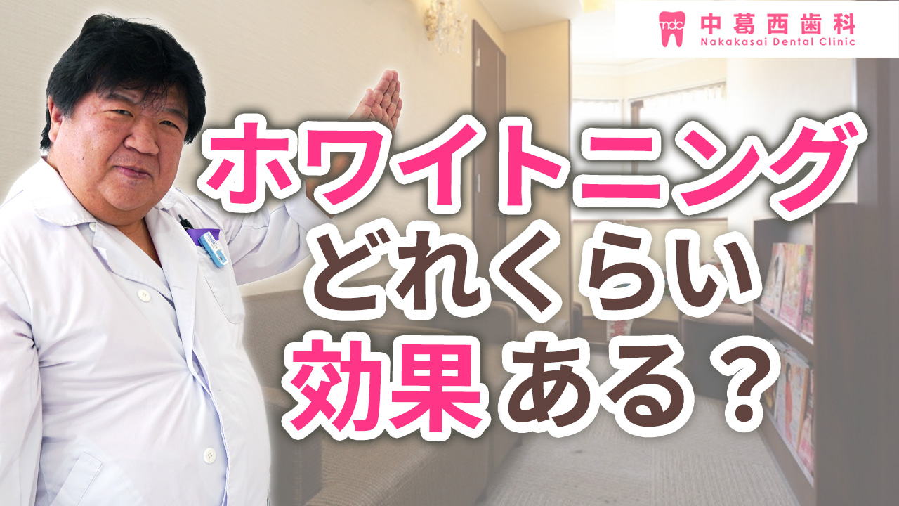 ホワイトニングってどれくらい効果があるのか？ | 中葛西歯科